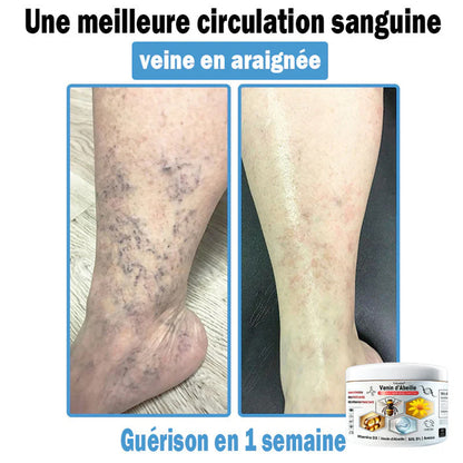 Trilumia®🥥30% de réduction supplémentaire