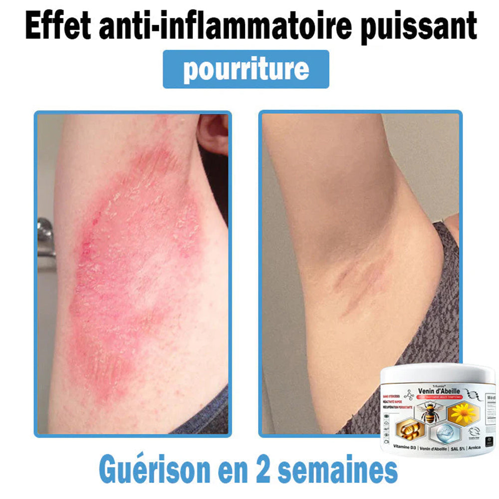 Trilumia®🥥30% de réduction supplémentaire
