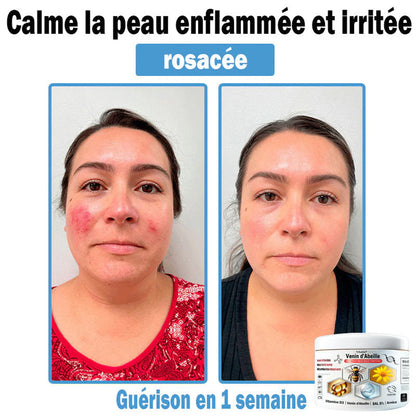 Trilumia®🥥30% de réduction supplémentaire