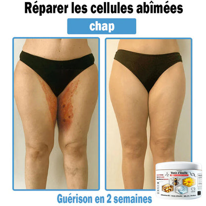 Trilumia®🥥30% de réduction supplémentaire