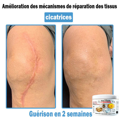 Trilumia®🥥30% de réduction supplémentaire