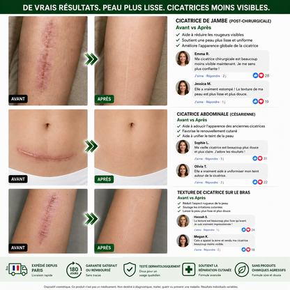 𝑩𝒐𝒖𝒕𝒊𝒒𝒖𝒆 𝒐𝒇𝒇𝒊𝒄𝒊𝒆𝒍𝒍𝒆 🇫🇷| 𝖲𝗎𝗋𝗀𝗈ᴎ𝗂𝗑® 📍𝐏𝐚𝙩𝙘𝙝 𝗡ano-Microneedles Avancé 10-en-1 Moringa · 𝘽𝙚𝙧𝙗é𝙧𝒊𝒏𝒆 × NAD⁺Une seule fois par jour, changements visibles en 7 jours Pour l’obésité, peau relâchée, diabète, apnée du sommeil, problèmes articulaires, et bien plus🍀